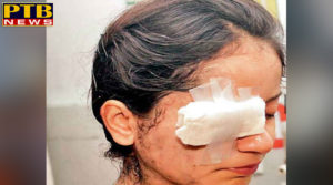 PTB Big City News punjab jalandhar news acid attack in jalandhar johal hospital dr. johal