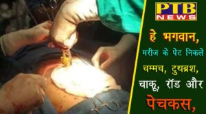 PTB Big Shocking News shimla doctors found toothbrush iron rod spoon and screwdriver in patient himachal pardesh mandi sundarnagar 