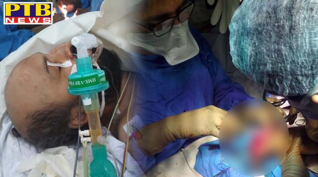 doctors in pgi are conducting operation to add policemans severed arm chandigarh Punjab Patiala