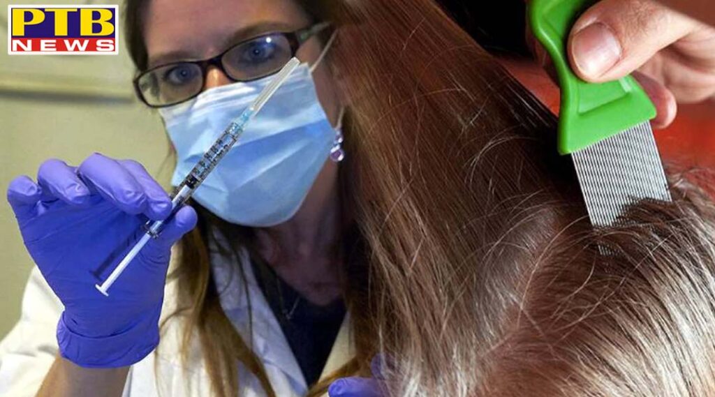 clinical trials of head lice drug ivermectin against covid begin coronavirus america