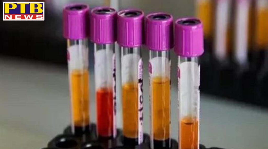 coronas patients rise again in nawanshahr 18 people report positive 7 new patients found in Chandigarh PTB Big Breaking News