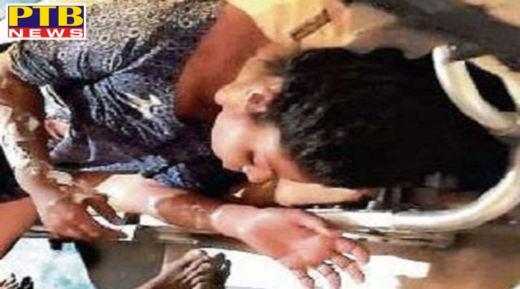 person threw petrol bomb at 2 real sisters in bathinda