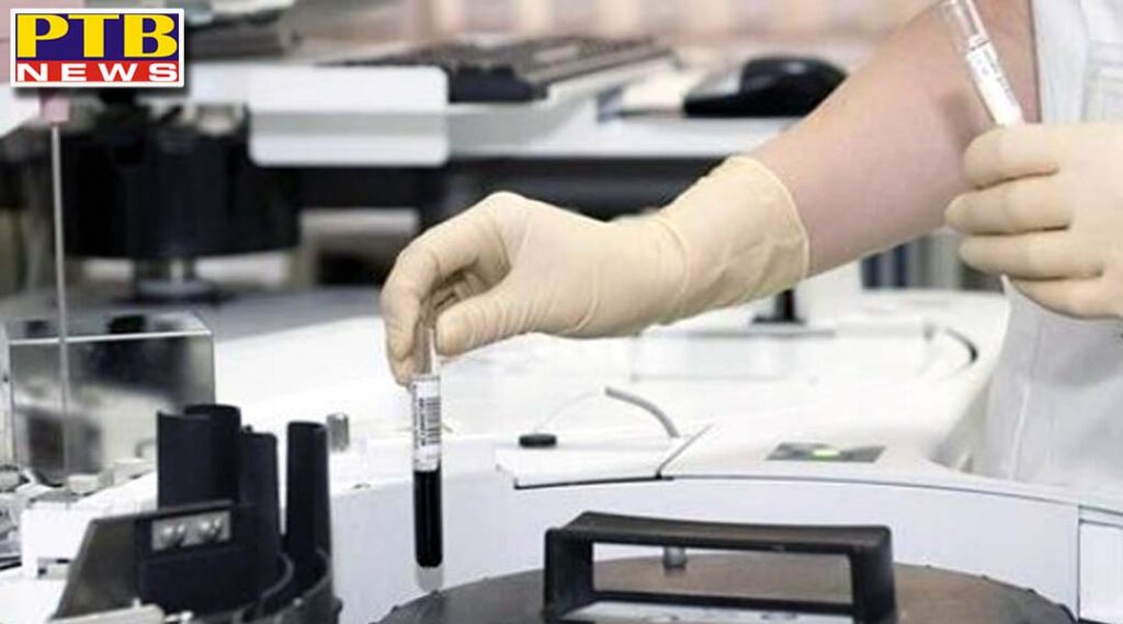 fir against sri lab of jalandhar charging 1500 instead of 450 for Covid19 test