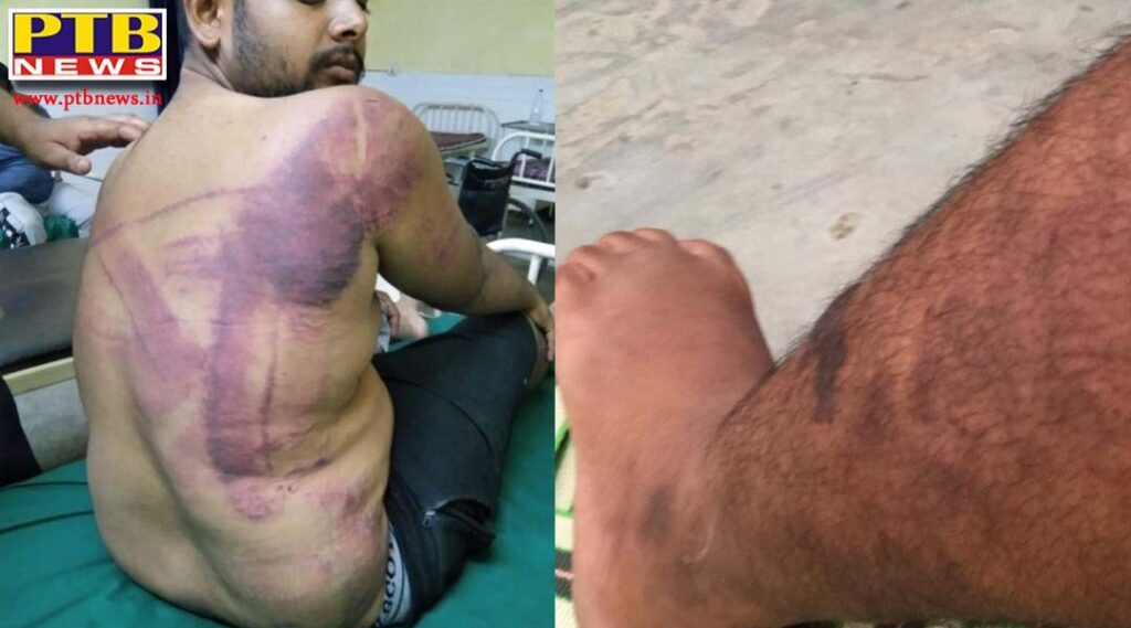 The youth was beaten by unknown youths, police started investigation Adda Cholang Punjab