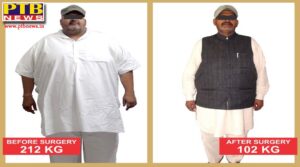 More than 100 kg can be reduced by weight, obesity Scientific treatment is bariatric surgery, Dr. GSJammu Jammu Hospital Jalandhar