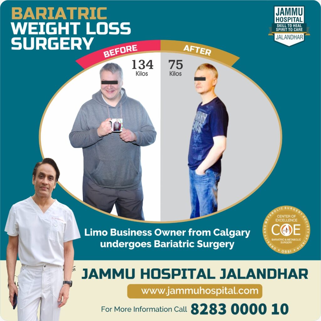 Bariatric surgery in Jammu Hospital Jalandhar will now be accessible to all DrGSJammu