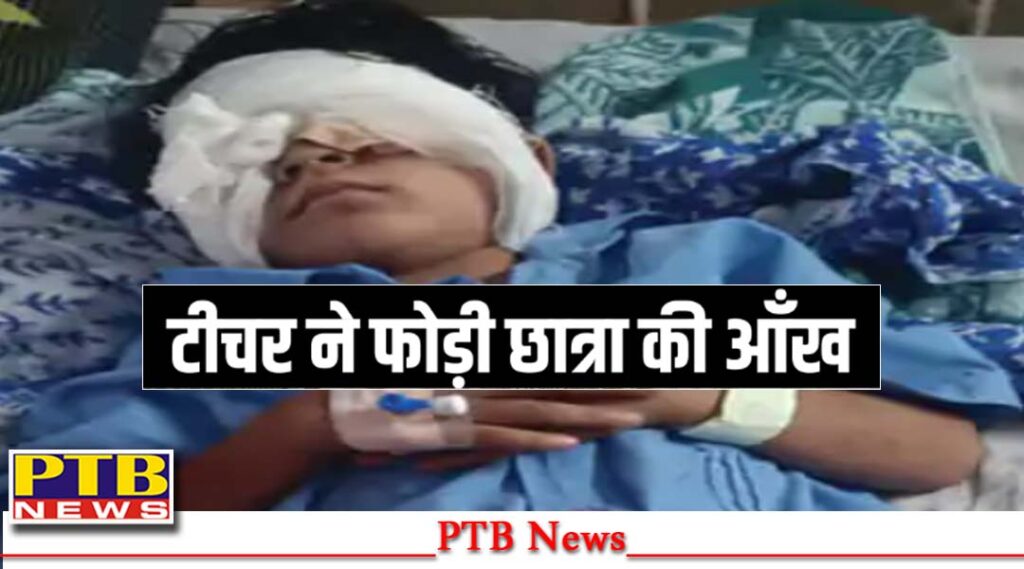 panipat-teacher-damaged-five-year-old-girl-student-eye-panipat-samalkha-haryana