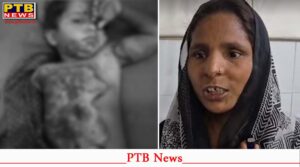 पंजाब : माचिस से खेलते-खेलते आग की चपेट में आई 3 साल की बच्ची, झुलसी, तड़पती रही 6 घंटे,