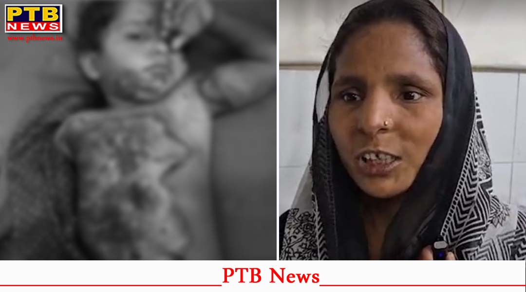 पंजाब : माचिस से खेलते-खेलते आग की चपेट में आई 3 साल की बच्ची, झुलसी, तड़पती रही 6 घंटे,